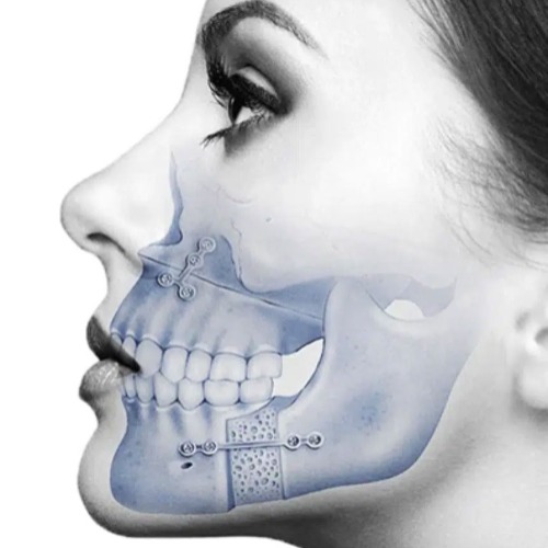 Maxillofacial Surgery